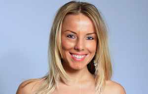 Apple cider vinegar benefits for skin 