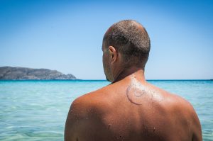 Tattoo removal before and after