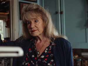 Wrinkles under eyes when smiling